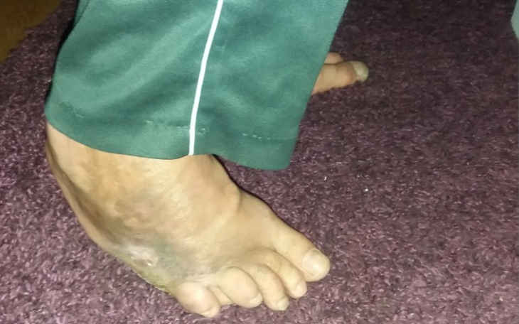 Zbiórka Proszę, uratujcie moją nogę! - zdjęcie główne