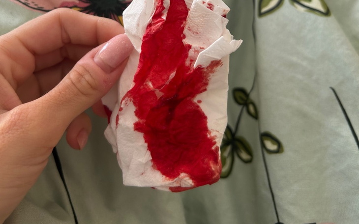 Zbiórka Ile warte jest życie 250 tys - zdjęcie główne