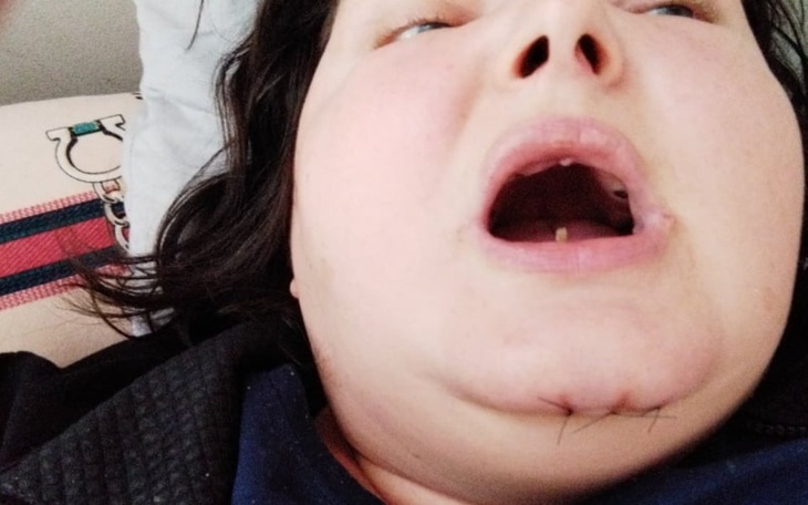 Zbiórka Pomoc dla Doroty Kowalczyk - zdjęcie główne