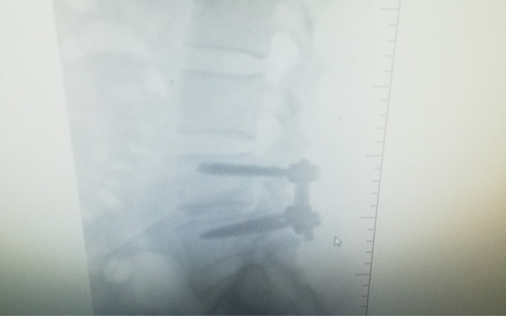 Zbiórka Opłata za operacje - zdjęcie główne