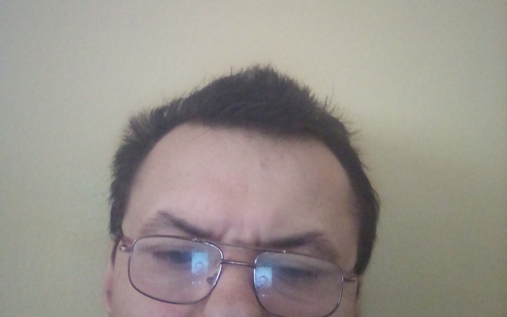 Zbiórka Na leki na opłaty mam niski zasi - zdjęcie główne