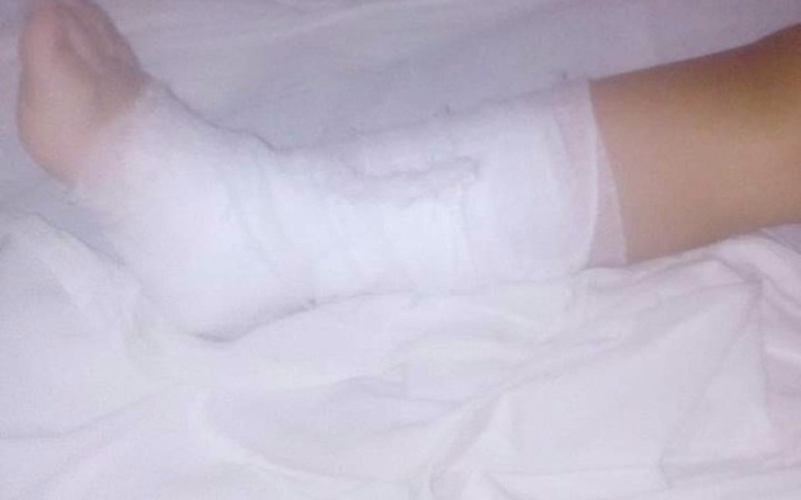 Zbiórka Zabieg fibrotomia - zdjęcie główne