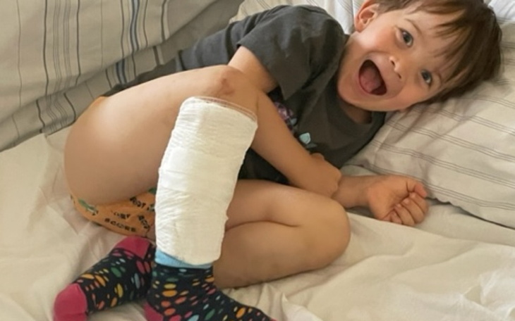 Uśmiechnięty chłopiec z opatrunkiem na nodze, leżący na łóżku.