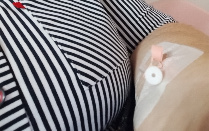 Zbiórka Na dlugi zbieranie - zdjęcie główne