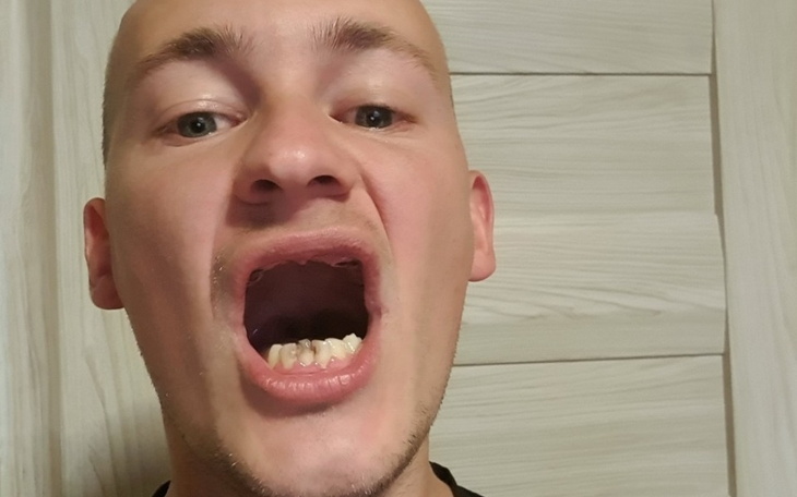 Zbiórka Pomoc na zabieg zębów - zdjęcie główne