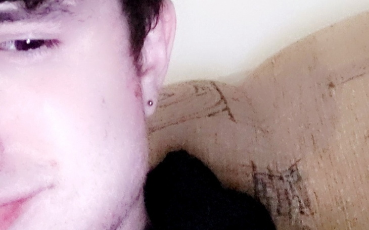 Zbiórka Zbiórka na leczenie ADHD - zdjęcie główne