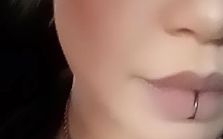 Zbiórka powrót do uśmiecha i zdrowia - zdjęcie główne