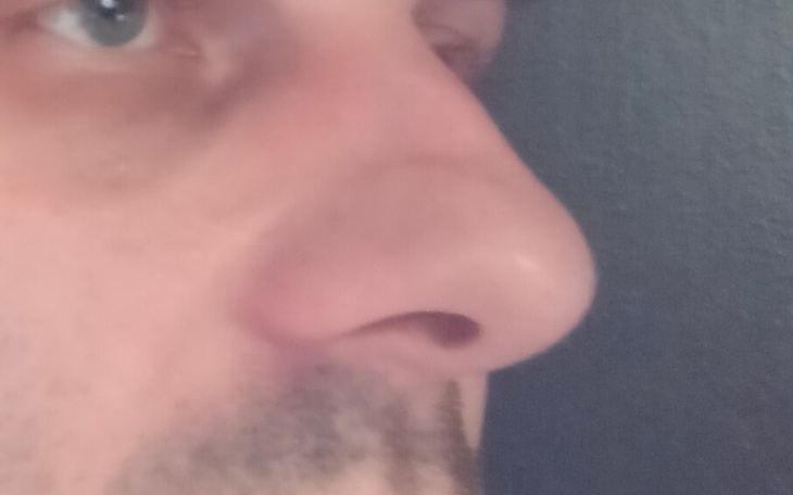 Zbiórka Uleczyć bezdech, zyskać życie - zdjęcie główne