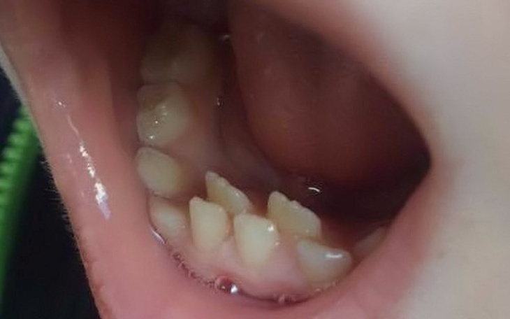 Zbiórka Proste ząbki - zdjęcie główne