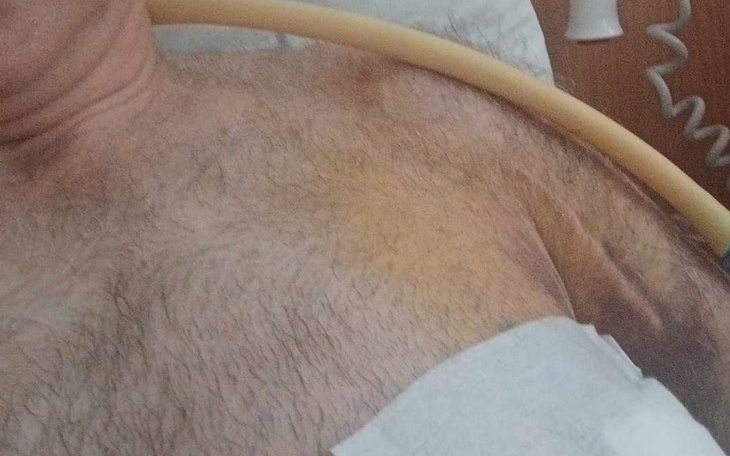 Widok na klatkę piersiową pacjenta w szpitalu.