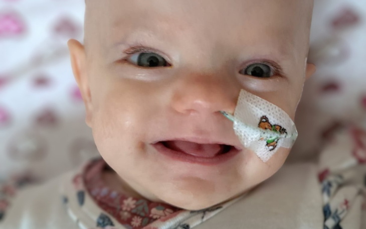 Uśmiechnięte niemowlę z opatrunkiem na nosie.