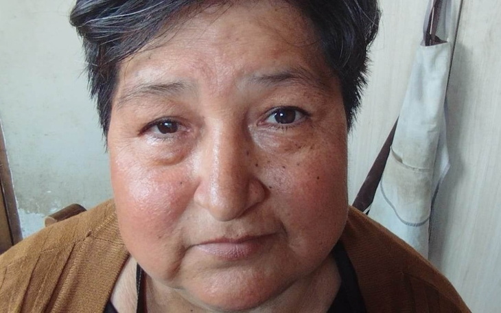 Zbiórka POMÓŻ SILVi POKONAĆ CIERPIENIE - zdjęcie główne