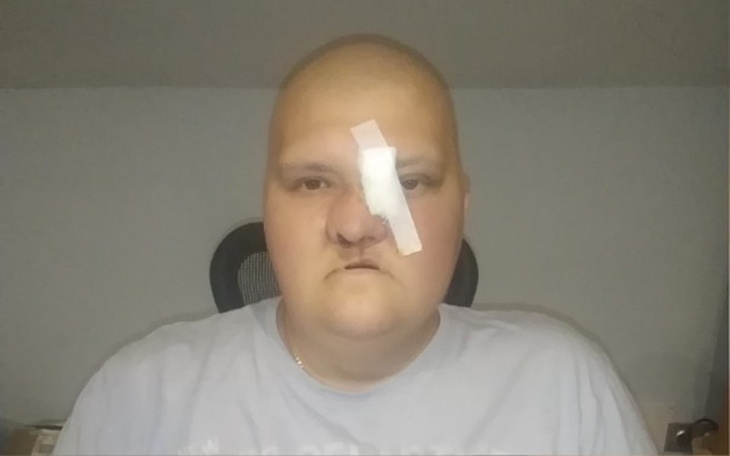 Zbiórka Dawid kontra rak złośliwy - zdjęcie główne