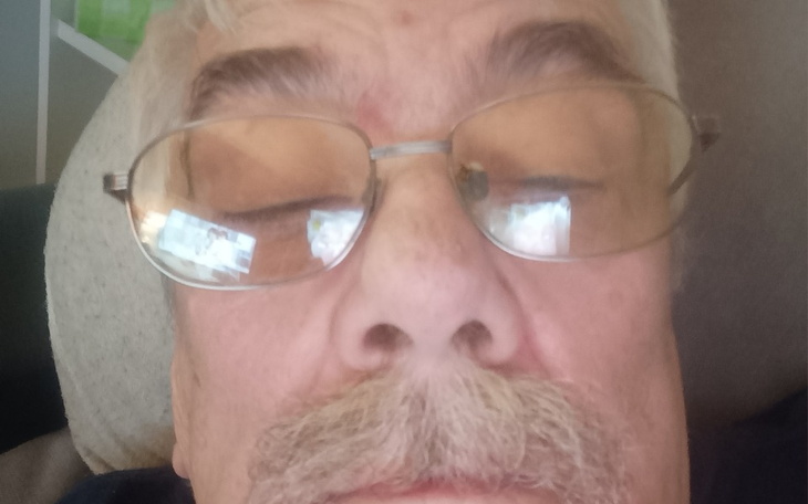 Zbiórka Operacja oczu. Grozi mi znaczą ś - zdjęcie główne