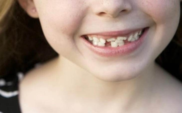 Zbiórka Aparat ortodontyczny, dla Pauli - zdjęcie główne