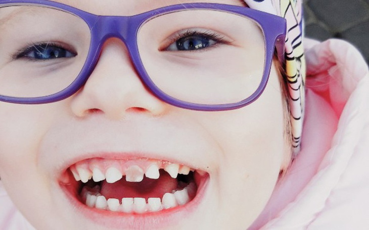 Zbiórka Rehabilitacja Agaty - zdjęcie główne