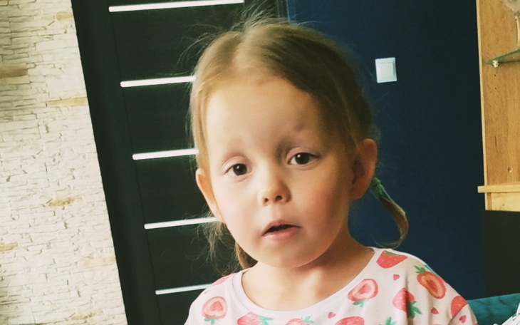 Mała dziewczynka z zaskoczonym wyrazem twarzy.