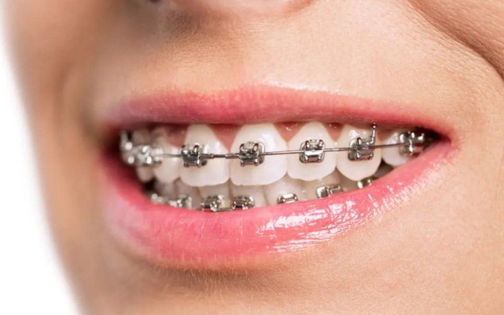 Zbiórka Pomóż mi wyprostowac zęby - zdjęcie główne