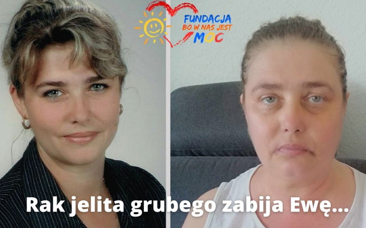 Zbiórka Rak jelita grubego zabija Ewę - zdjęcie główne