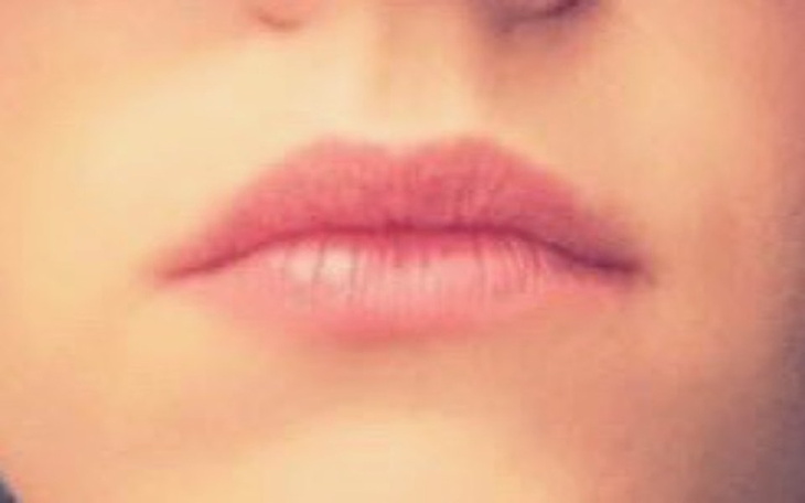 Zbiórka Odzyskać uśmiech - zdjęcie główne