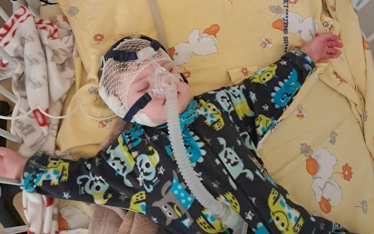 Małe dziecko w szpitalu, z maską tlenową na twarzy.