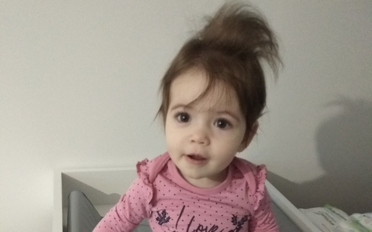 Zbiórka Leczenie i rehabilitacja Poli - zdjęcie główne