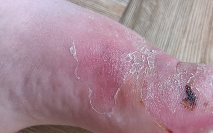 Zbiórka Zbieram na leki, opatrunki - zdjęcie główne