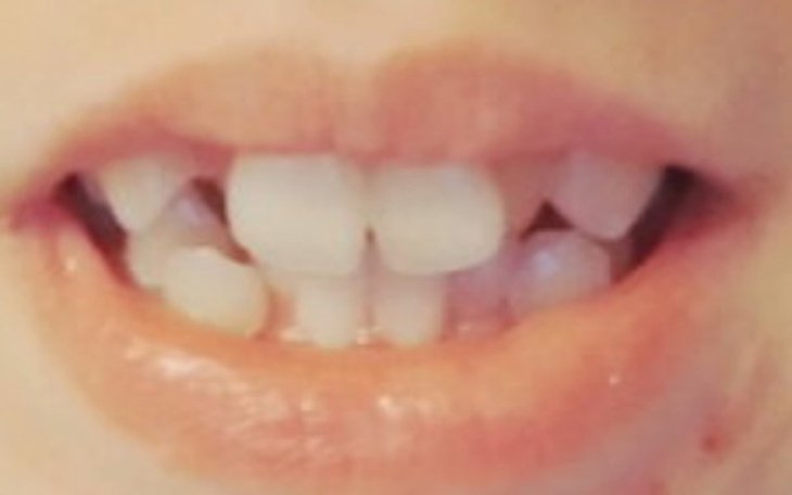 Zbiórka Aparat ortodontyczny ;( - zdjęcie główne