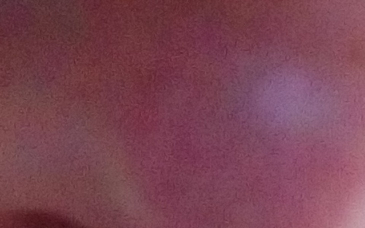 Zbiórka Zbieram na operację twarzy - zdjęcie główne