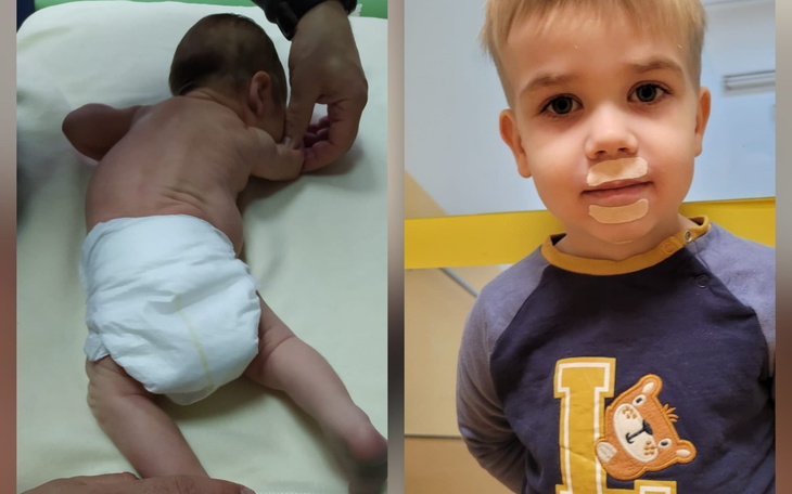 Noworodek na stole, obok dziecko z plasterkiem na twarzy.