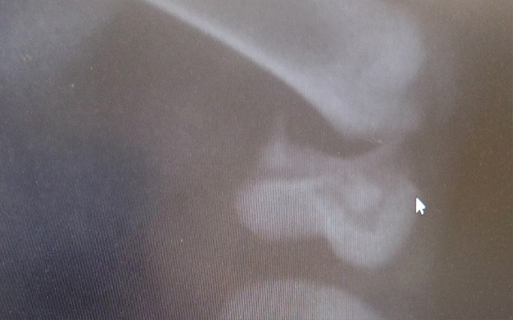 Zbiórka Na operację złamanej nóżki - zdjęcie główne