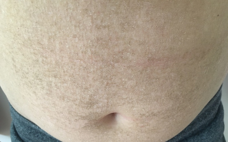 Zbiórka Wsparcie dziecka w cierpieniu - zdjęcie główne