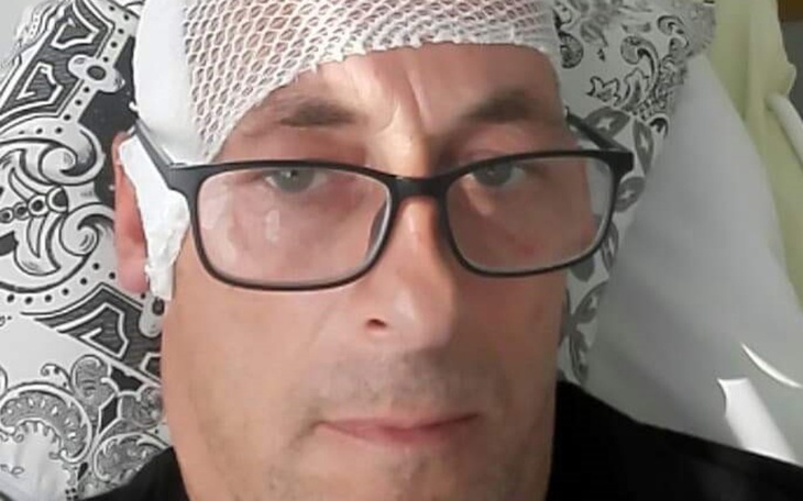 Mężczyzna w szpitalu z opatrunkiem na głowie.