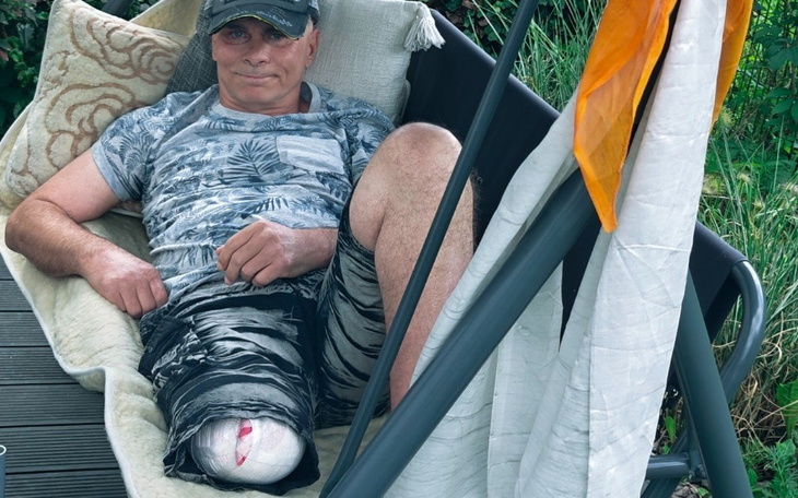 Zbiórka Zbieram na nową nogę - zdjęcie główne