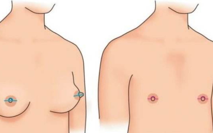 Zbiórka By wreszcie być sobą - zdjęcie główne