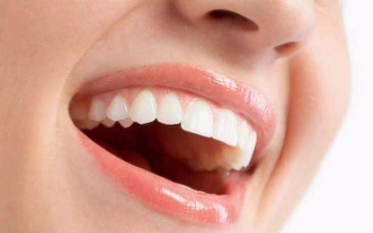 Zbiórka Nowe zeby -piekny usmiech - zdjęcie główne