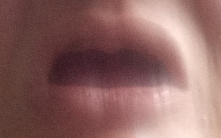 Zbiórka Na protezy zębowe - zdjęcie główne