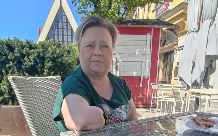 Zbiórka Proteza przedramienia - zdjęcie główne