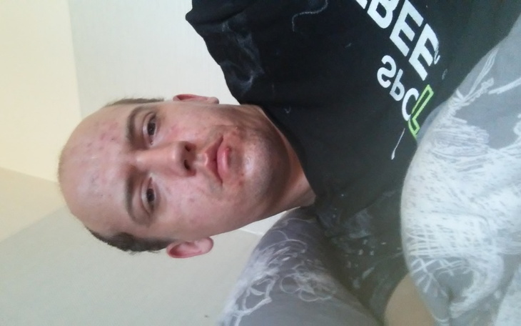 Zbiórka Na telefon i leczenie - zdjęcie główne