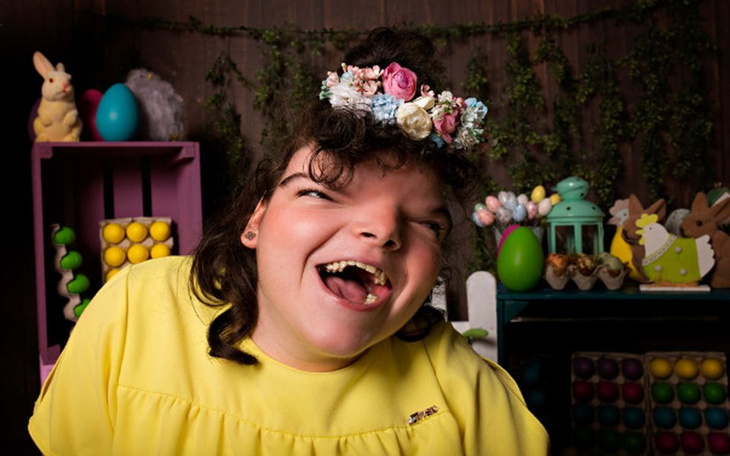 Zbiórka Rehabilitacja dla Izy - zdjęcie główne