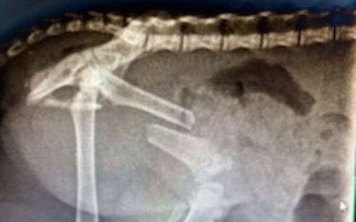 Rentgen przedstawiający kości.