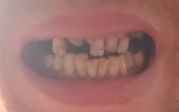 Zbiórka Leczenie zębów na nowy uśmiech - zdjęcie główne