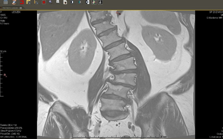 Zbiórka Na długą rehabilitację - zdjęcie główne