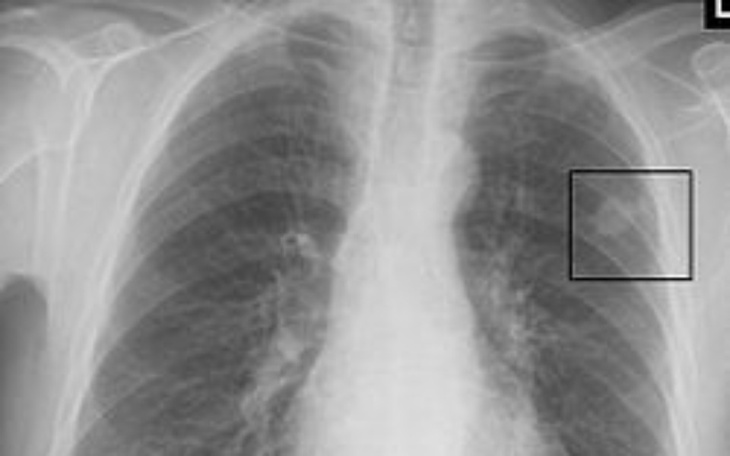 Zbiórka Choroba - marzenia - zdjęcie główne