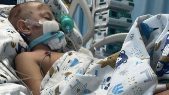 Zbiórka Pomoc dla poszkodowanego Adasia - miniaturka zdjęcia