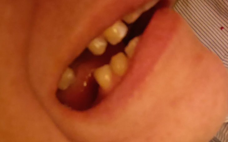 Zbiórka Nowe zęby pomoc - zdjęcie główne