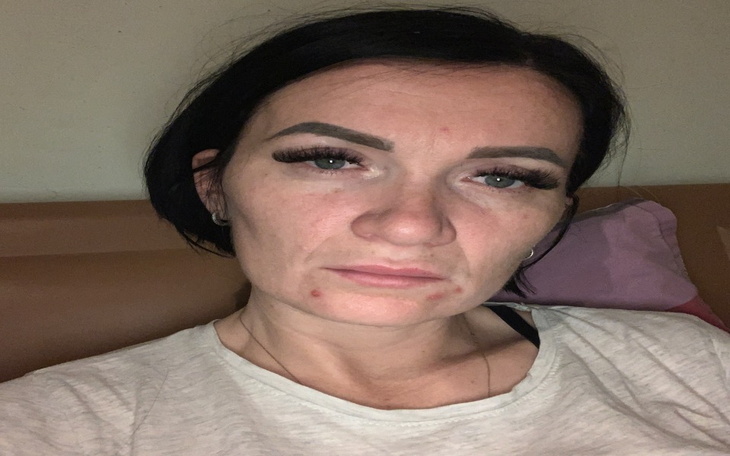 Zbiórka Na operacje mięśniaka macicy - zdjęcie główne