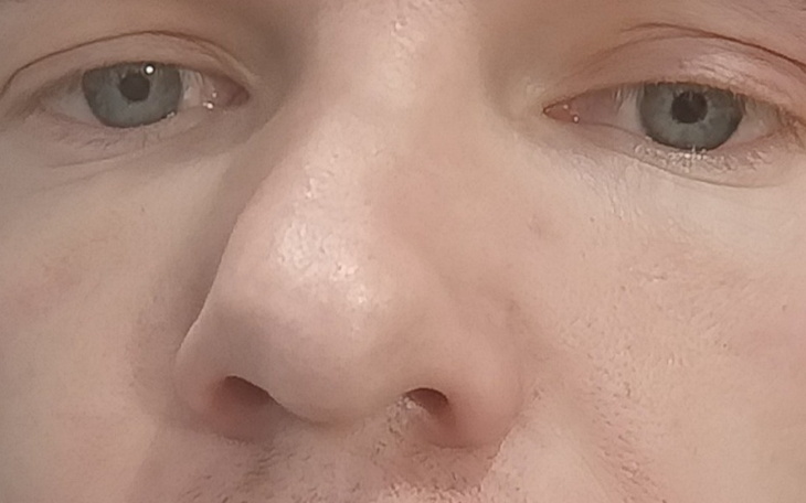 Zbiórka Operacja krzywego nosa. - zdjęcie główne