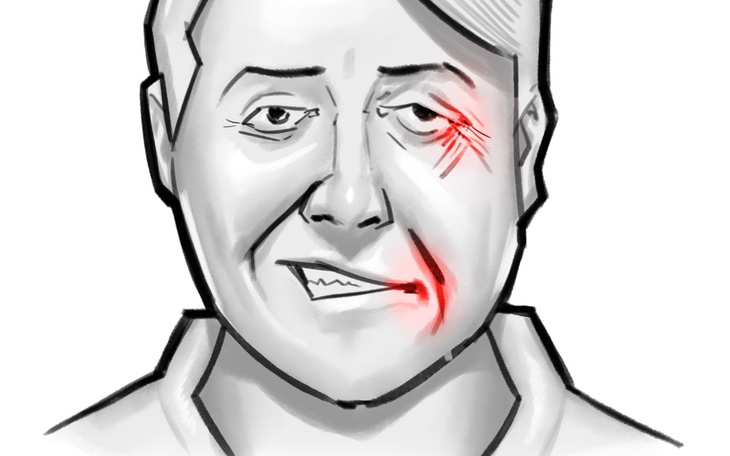 Zbiórka Rehabilitacja twarzy - zdjęcie główne