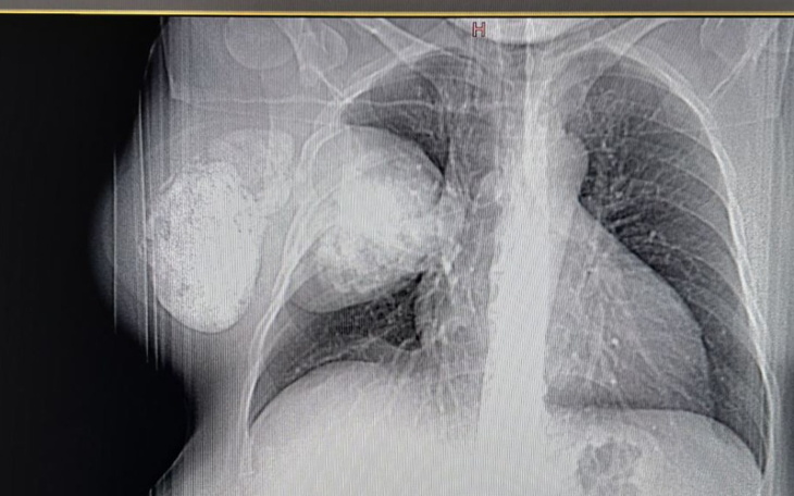 Zbiórka Operacja,reabiliatsiya - zdjęcie główne